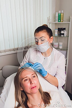 Platelet rich plasma injection procedure. Hair growth stimulation. PRP therapy process. Stock Photo