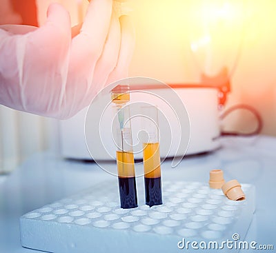 Platelet-Rich plasma preparation. Plasma in syringe. Centrifuge. Stock Photo