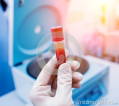 Platelet-Rich plasma preparation. Plasma in syringe. Centrifuge. Stock Photo