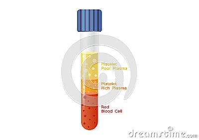 Platelet-Rich plasma procedure stages / prp / Centrifuge vector Vector Illustration