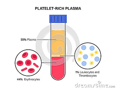 Platelet rich plasma concept Vector Illustration