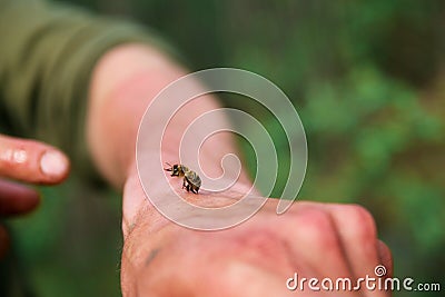 Bee sting. a bee stung a man and left a sting in his hand Stock Photo