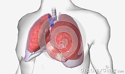 Pleural effusion is a lung condition characterized by fluid buildup outside the lungs Stock Photo