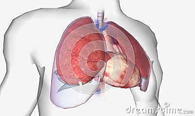 Pleural effusion is a lung condition characterized by fluid buildup outside the lungs Stock Photo