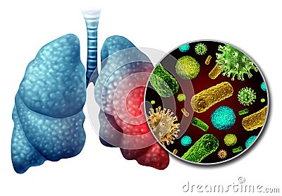 Pneumonia Infection Anatomy Cartoon Illustration