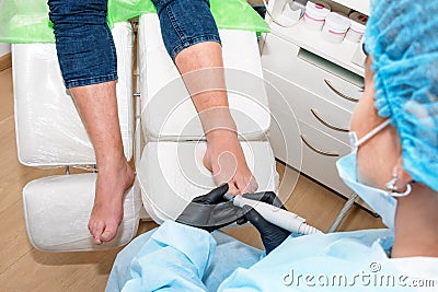 Podology treatment. Podiatrist treats foot. Podiatry doctor or dermatologist treats the patient in modern clinic Editorial Stock Photo