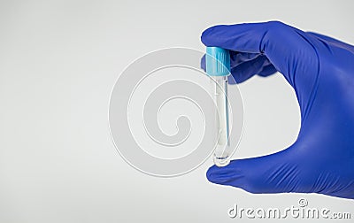 Hand of a doctor holding a bottle for samples. Stock Photo