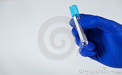 Hand of a doctor with blue glove on it holding a bottle for samples. Stock Photo