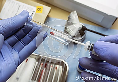 Police expert checks samples chemical as fundamental test in a murder case in crime lab Stock Photo