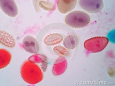 A pollen grain is a microscopic body Stock Photo