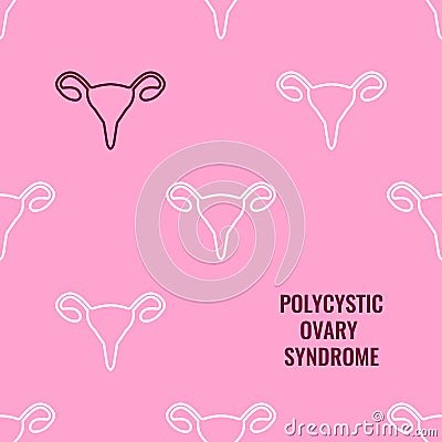 Polycystic ovary syndrome awareness medical poster in linear style Vector Illustration