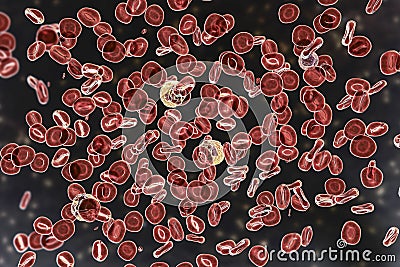 Polycythemia vera, a rare slow-growing blood cancer with an increase in the number of red blood cells Cartoon Illustration