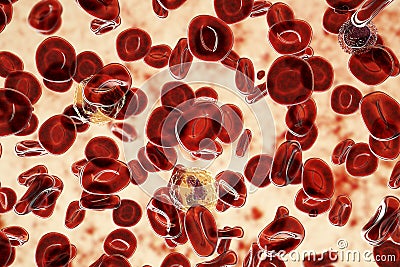 Polycythemia vera, a rare slow-growing blood cancer with an increase in the number of red blood cells Cartoon Illustration