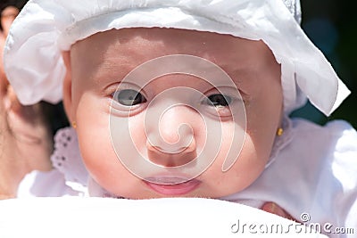 Portrait of a baby girl with blocked tear ducts of one eye Stock Photo