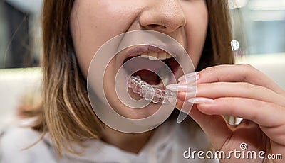 Portrait of beautiful girl patient holding orthodontic retainers aligners in dental clinic. Stock Photo