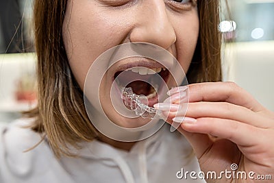 Portrait of beautiful girl patient holding orthodontic retainers aligners in dental clinic. Stock Photo