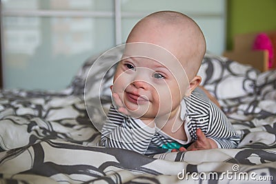 Portrait of cute baby boy with Down syndrome Stock Photo