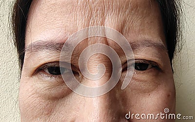 The Flabby sagging and forehead lines on the face. Stock Photo