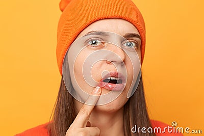 Portrait of sick shocked woman wearing orange jumper and beanie hat standing isolated over yellow background, has oral herpes, Stock Photo