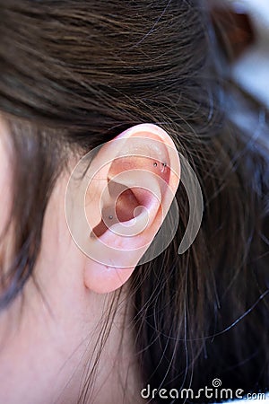 A portrait of three ear seeds sticked inside of the ear of a woman. The alternative treatment is a way to help relieve pain, Stock Photo