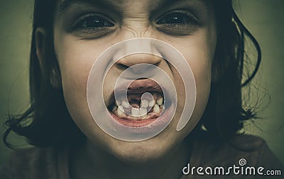 Portrait of toothless child girl missing milk and permanent teeth Stock Photo