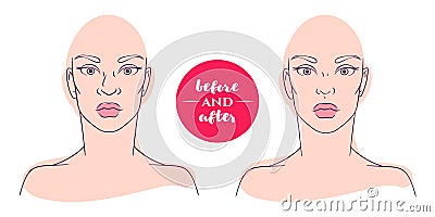 Portrait of a woman before and after with cosmetic defects. Vector Illustration