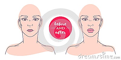 Portrait of a woman before and after with cosmetic defects. Vector Illustration