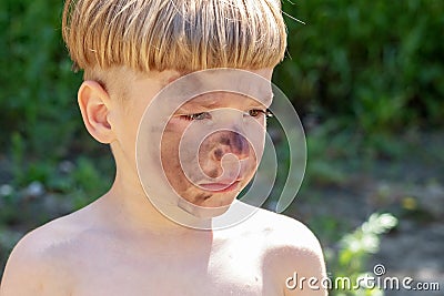 Portrait of a 5 year old boy with a hurt and dirty face. The boy is upset by the injustice. Stock Photo