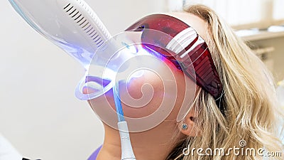 Closeup portrait of youn gblonde woman sitting in dentist chair during teeth whitening procedure with photopolymer Stock Photo