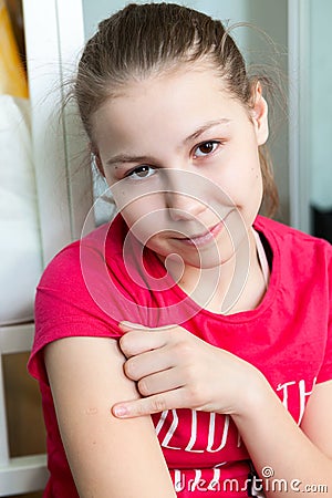 Portrait of young girl is showing red mark of BCG vaccination on her shoulder Stock Photo