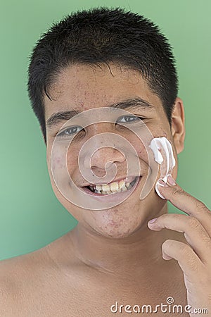 Portrait of young man with white cream. problematic skin and hyperpigmentation on his face smiling at camera Stock Photo