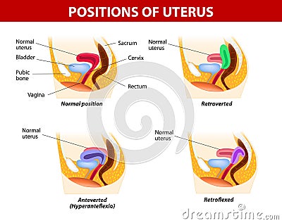 Positions of uterus Vector Illustration