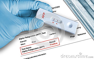 Positive AFP test result by using rapid self testing cassette for Alpha Fetoprotein Stock Photo