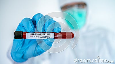 Positive COVID-19 test and laboratory sample of blood new Corona virus infection Stock Photo