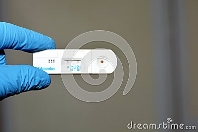 Positive result of HCV and negative HIV and HBV in a rapid test cassette kit for HBV, HIV and HCV Stock Photo