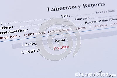 Positive test result of COVID-19 Stock Photo