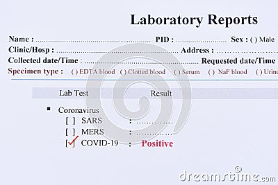 Positive test result of COVID-19 Stock Photo