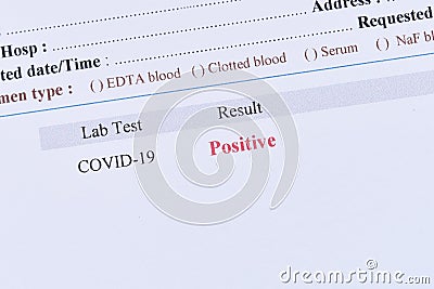 Positive test result of COVID-19 Stock Photo