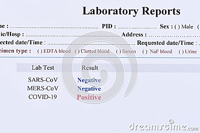 Positive test result of COVID-19 virus Stock Photo