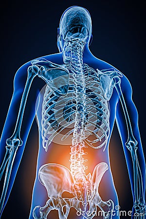 Posterior or back view of human spine or spinal column with inflammation or injury 3D rendering illustration. Pathology, backbone Cartoon Illustration