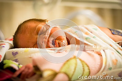 Preemie baby girl sleeping in the incubator Stock Photo