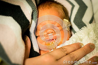 Preemie baby girl sleeping in the incubator Stock Photo