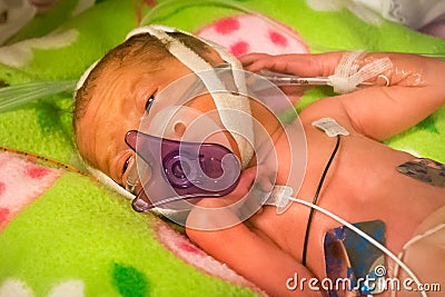 Preemie baby girl sucking on her pacifier Stock Photo