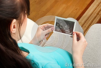 Pregnancy Stock Photo