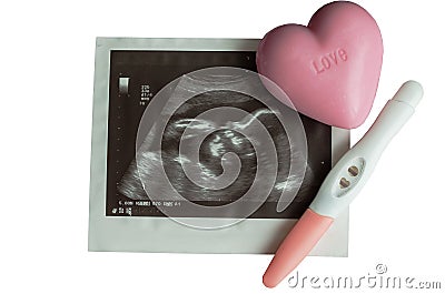 Pregnancy concept with ultrasound picture of baby Stock Photo