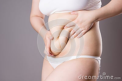 Pregnancy line - linea nigra, tummy tuck, overweight female body and flabby belly on gray background Stock Photo