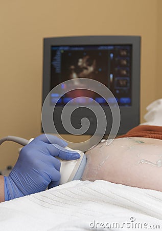 Pregnancy Sonogram Stock Photo