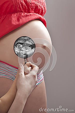 Pregnancy ultrasonic image Stock Photo