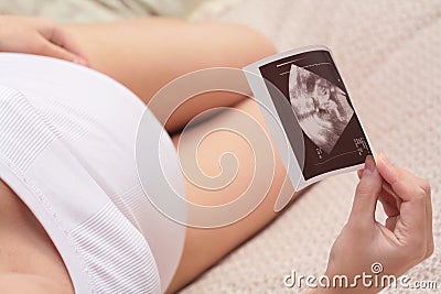 Pregnancy, ultrasonic portrait of the fetus Stock Photo