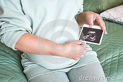Pregnant belly with ultrasound result picture. Woman see unborned kid face Stock Photo